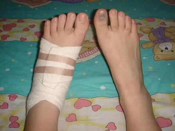 追答: 受伤了 大脚丫子 追问: 额 评论| 0 0