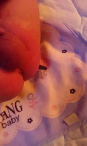 宝宝屁股红.而且起的红点上,好像有小水泡,有宝妈知道这是怎么回事吗?