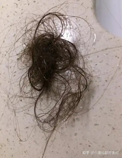 每次洗头那就像是一个大型的剃度现场,满地头发其实我之前头发真挺多