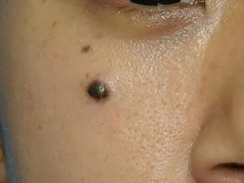 在_圈子-新氧美容整形