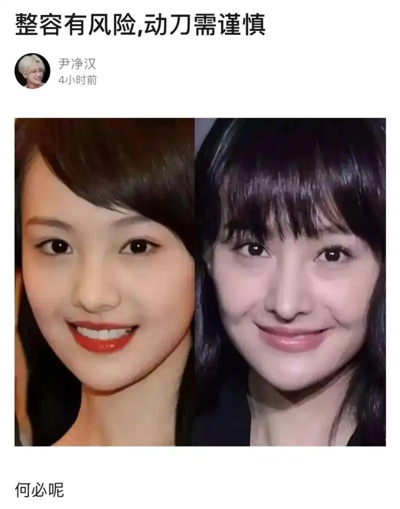 对比郑爽刚出道时期和现在的照片,大家觉得变化大吗