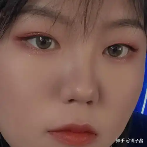 眼睛一单一双是什么体验