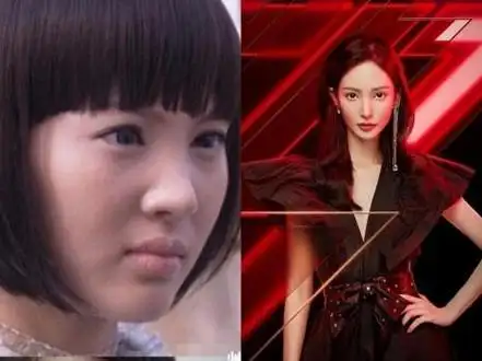 整容前后对比女星 整容女星前后照片