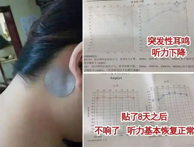 世界艾乡资讯-耳鸣不要慌,每天按几下这个穴位,疏通耳窍,耳朵终于清净