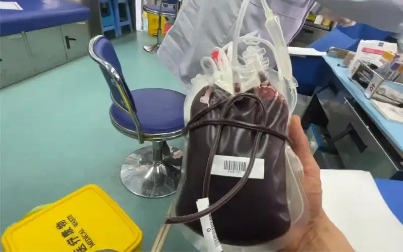 5分钟放完400cc血,再摸到还是热乎的是种什么体验?_哔哩哔哩_bilibili