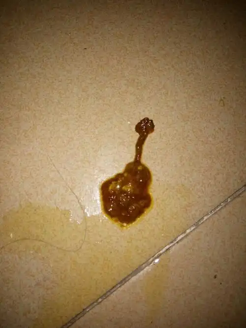 他是不是拉肚子了?