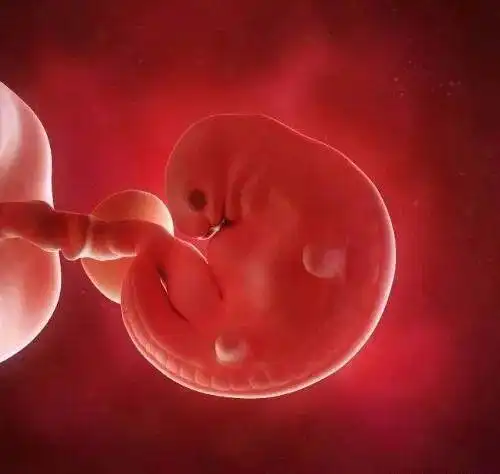 同卵双胞胎|孕囊|怀孕