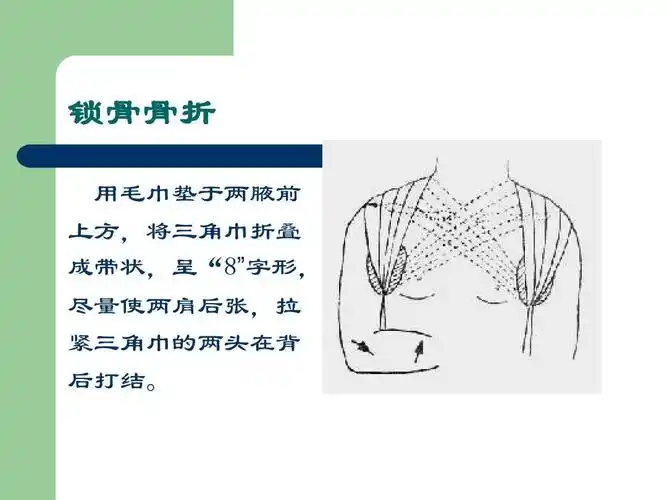 上方,将三角巾折叠 成带状,呈"8"字形, 尽量使两肩后张,拉 紧三角巾的