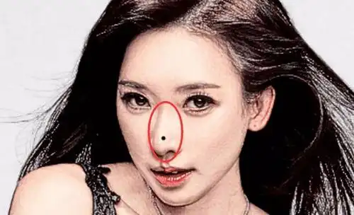 脸上一定要留的吉痣,有财有福,荣华富贵痣!