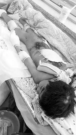 遭虐待遍体鳞伤的彤彤