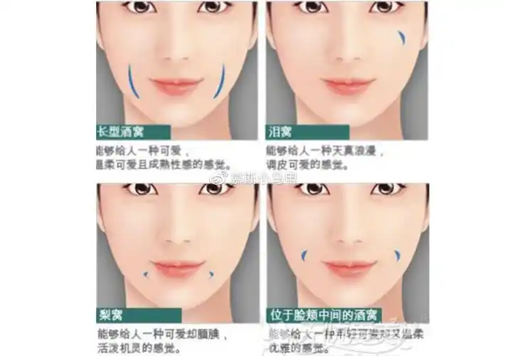 酒窝和梨涡有哪些区别呢?酒窝用埋线还是切开比较好呢?