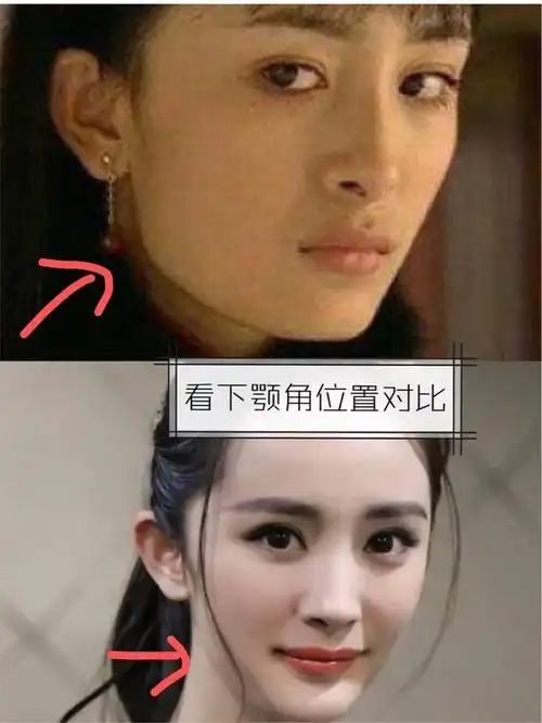 以【杨幂】举例 ._圈子-新氧美容整形