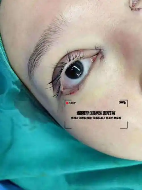 兰州微整形行业怎么入门