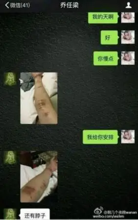 乔任梁生前最后综艺脖子上有明显伤痕