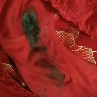 我想问一下怀孕7个月多了 内裤上有这个黑乎乎的是什麼?