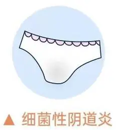 双唑泰阴道凝胶 | 私处白带颜色,症状反映妇科炎症,女生必看!