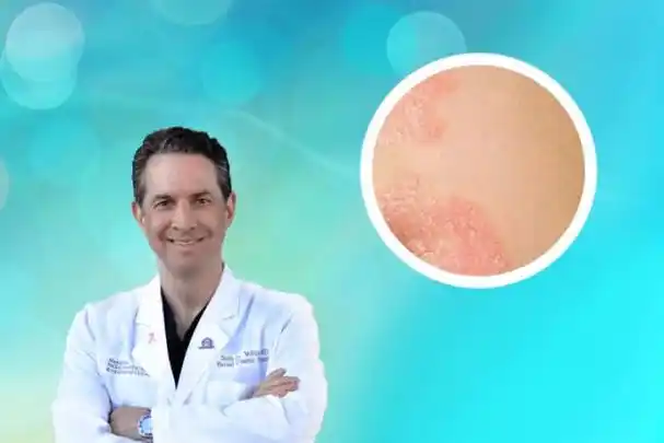 老公有股癣同房得霉菌