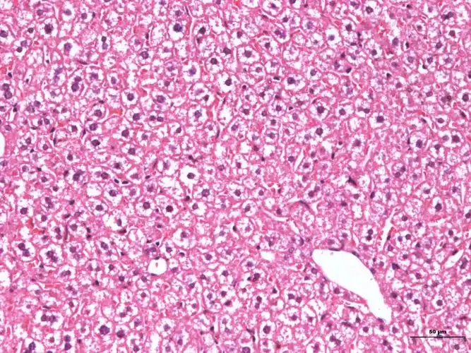 小鼠肝h&e染色图片,这些白色是脂肪变性或细胞肿胀吗?