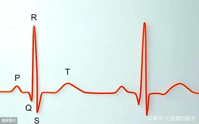 典型心电图阅读与解析:左心室肥厚