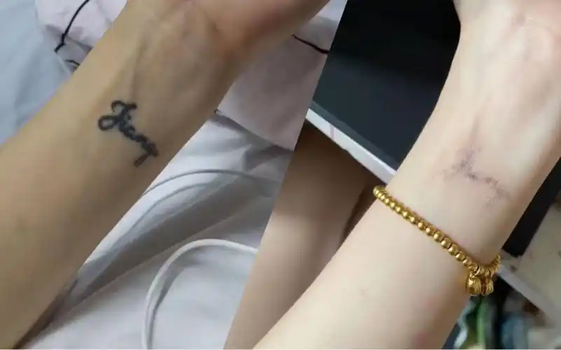 洗纹身会留疤吗纹身清洗4次真实效果对比