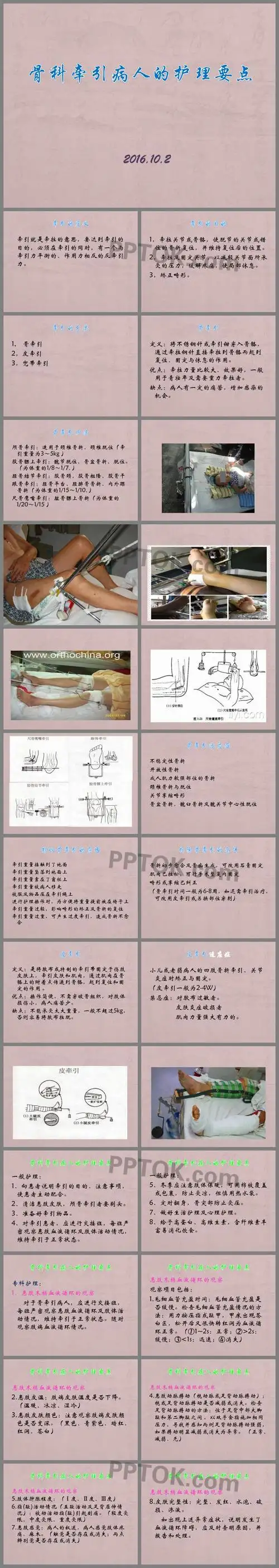 骨科牵引护理ppt课件