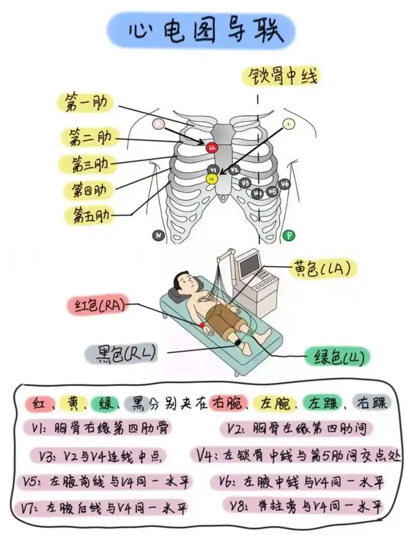 心电图导联位置区分!
