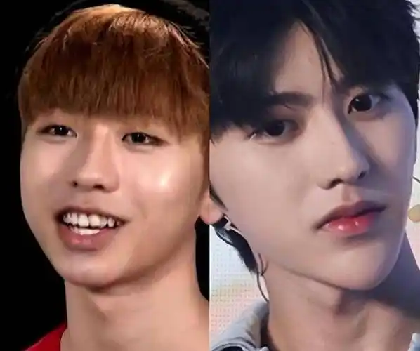 蔡徐坤整容对比前后图片 蔡徐坤前东家晒练习生整形费用事件始末