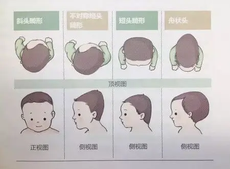 众安老年人重疾险 众安100种重大疾病有哪些