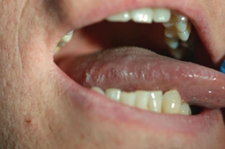 "人活一张脸,树活一张皮",关注hiv感染者的皮肤健康