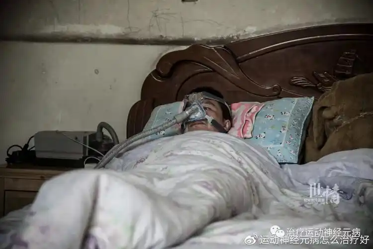 渐冻人渐冻症这个方法可以救命