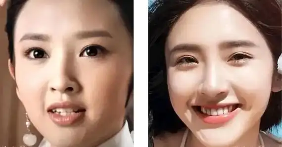 明星整牙前后气质变化
