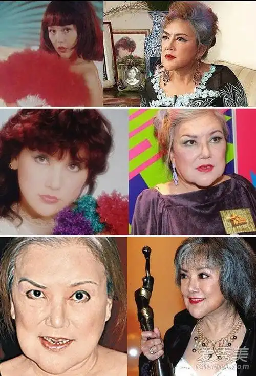 下巴整形失败的女明星