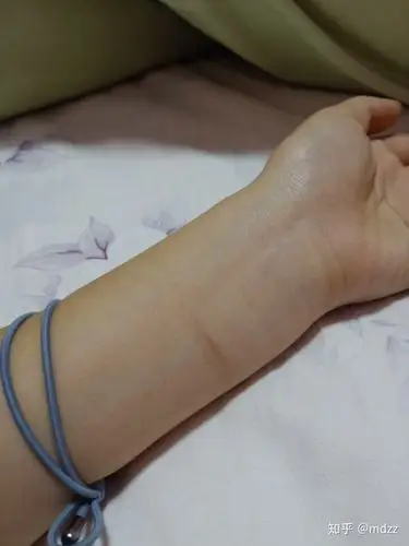 抑郁症要早点治疗.不值得放弃生命啊