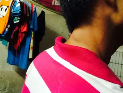 后颈部长了个肉包,不疼不痒,只是感觉有点不舒服