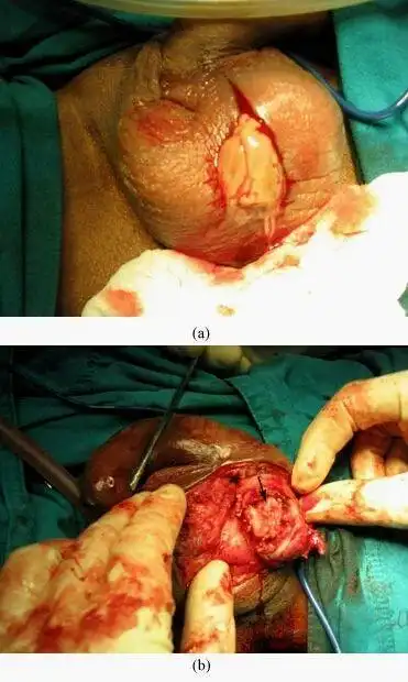 藏獒睾丸炎症状