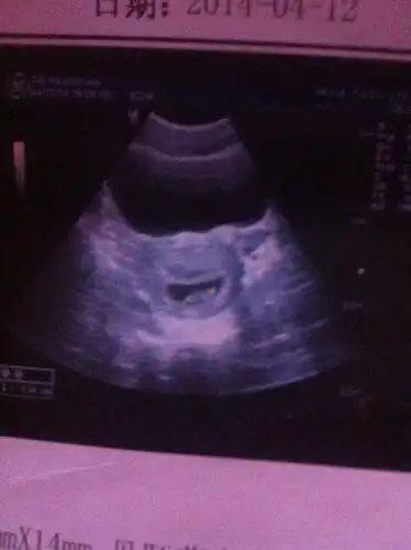 是男孩机率大还是女孩机率