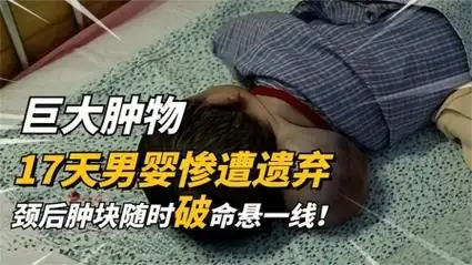 17天男婴有"两个脑袋"?惨遭亲生父母抛弃,他能重获新生吗