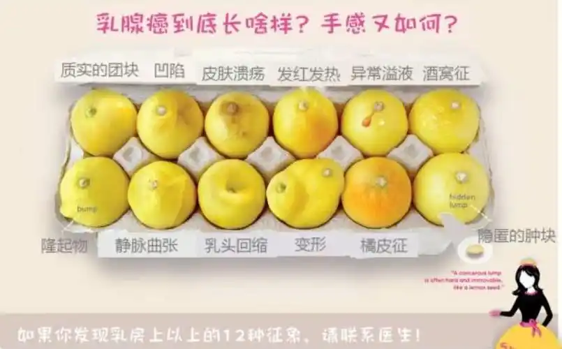 孕期发现乳腺癌6轮化疗后她和孩子怎么样了