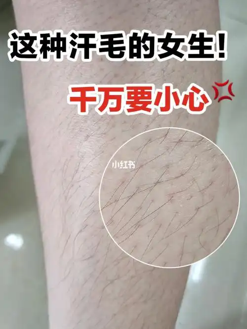 猕猴桃女生注意7215青春期脱毛93绝毛6015_脱毛_脱毛膏