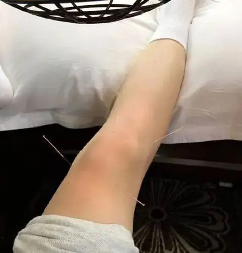 也为了拍打戏,留下后遗症,膝盖严重积水,所以很长时间每天早上开工都