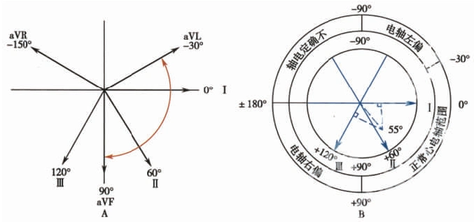 协会主张所有的计算机心电图分析程序都应使用面积法决定qrs平均电轴
