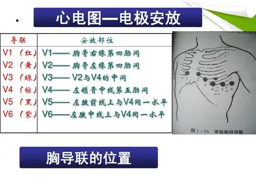 讲座版心电监护仪的使用ppt   导联 心电图—电极安放 安放部位 v1
