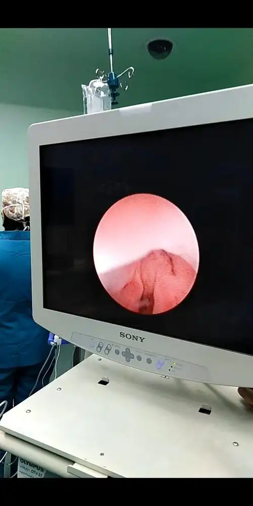 尿道外口开口到阴道,12点为尿道口.