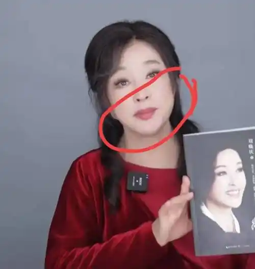 70岁刘晓庆最新近况曝光,面部僵硬做表情困难,医美后遗症太明显_少女