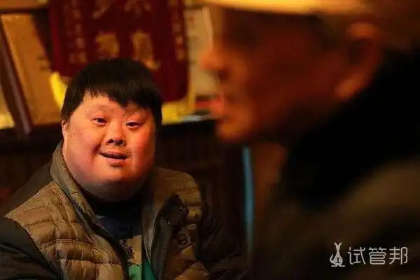 唐氏综合征患者能活到多少岁 怎样降低发病率_试管婴儿百科-试管邦