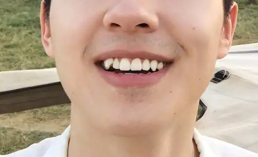 4位男艺人的虎牙,只有一张是王俊凯的,真爱粉的你能几秒找到呢