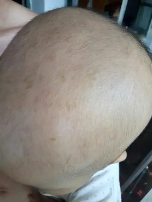 用手摸上去什么都没有,可眼看的话就有一块一块的