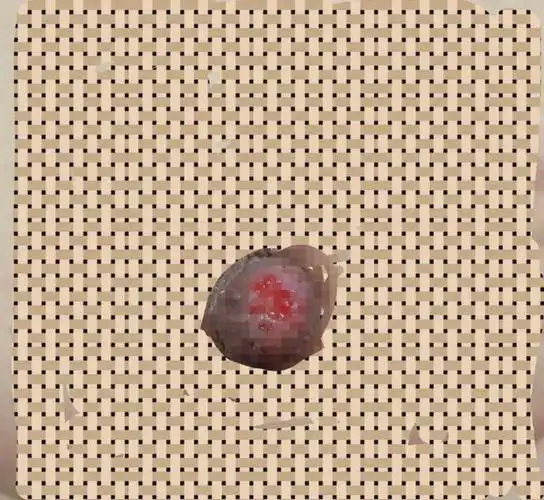 肿块|活检|乳腺癌_网易订阅