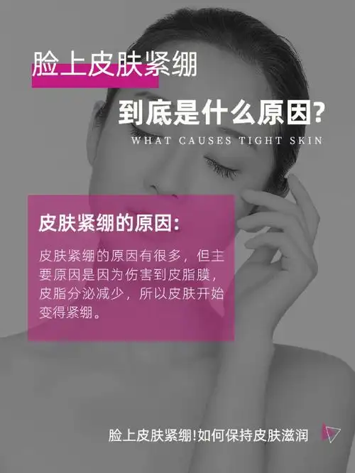 脸上皮肤紧绷怎么办保持皮肤滋润的秘诀