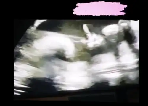 水果姐晒b超视频 腹中胎儿宝宝似乎在跟妈妈"打招呼"